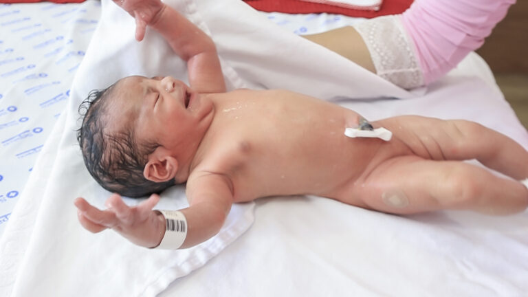 Frame NC2169 Manuella-129