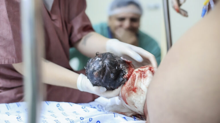 Frame NC2169 Manuella-22