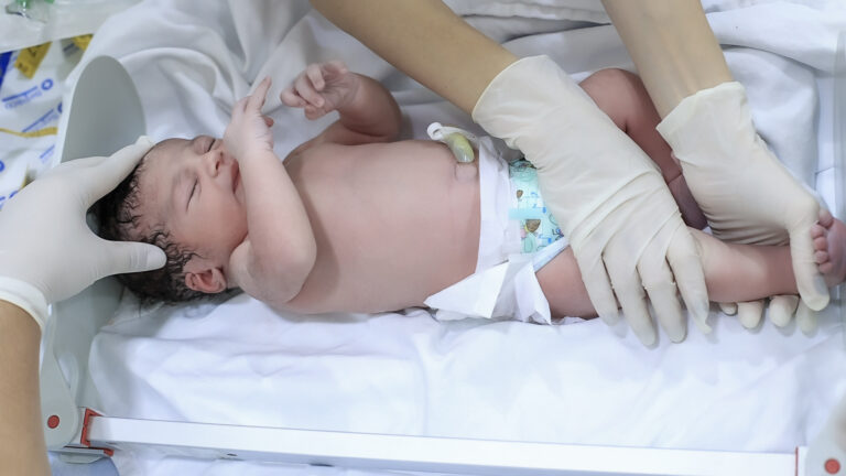 Frame NC2169 Manuella-63